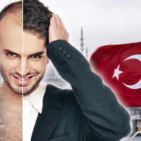 تركيا لزراعة شعري