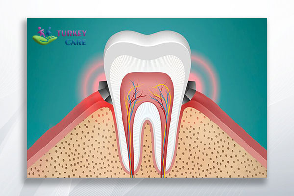 امراض وجراحة الاسنان